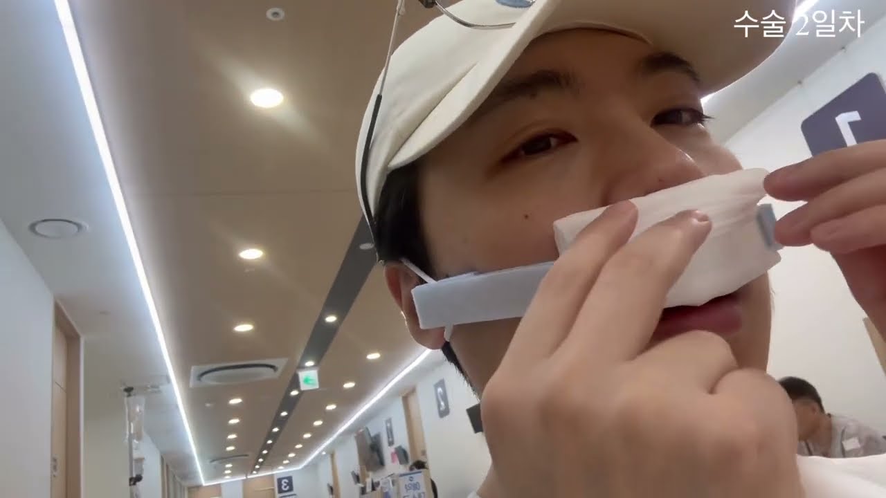 비중격만곡증 마지막 후기 😋 