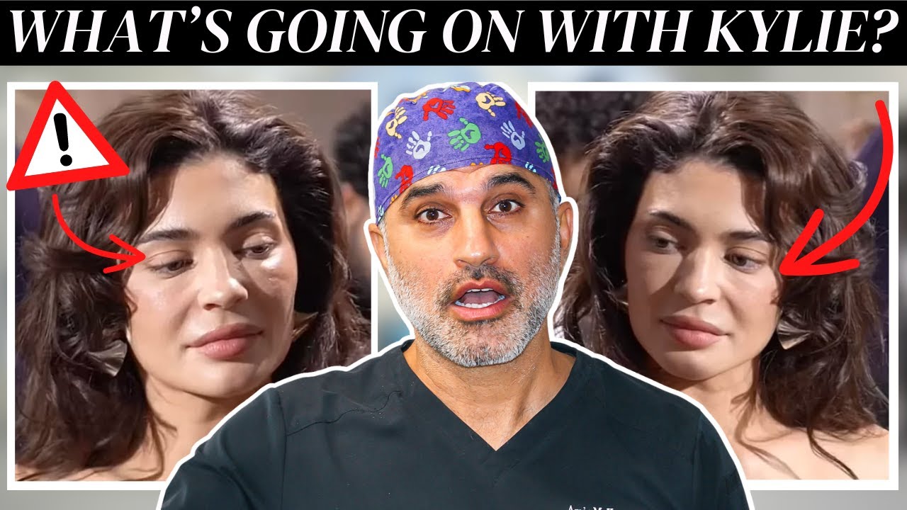 What is going on with Kylie Jenner's face?
