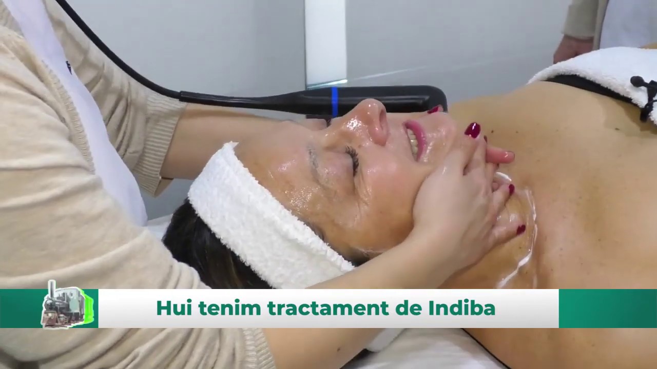 Tratamiento Indiba. PARTE 2