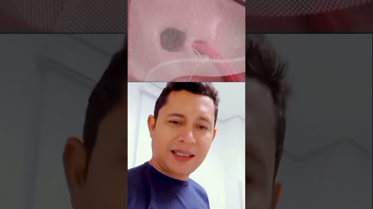 Cirurgia hérnia inguinal