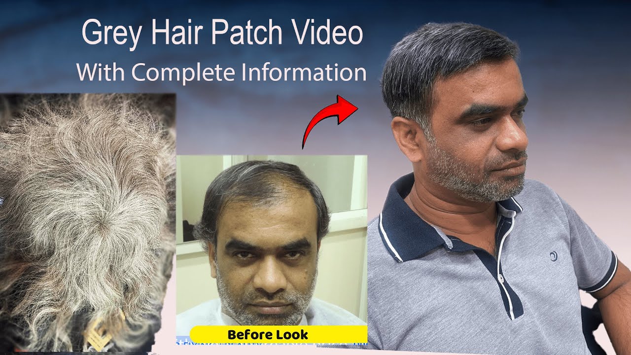 Hair patch video| Grey hair patch for aged cus | Hair Fixing in Bangalore| Cal 9110221804/9742549827