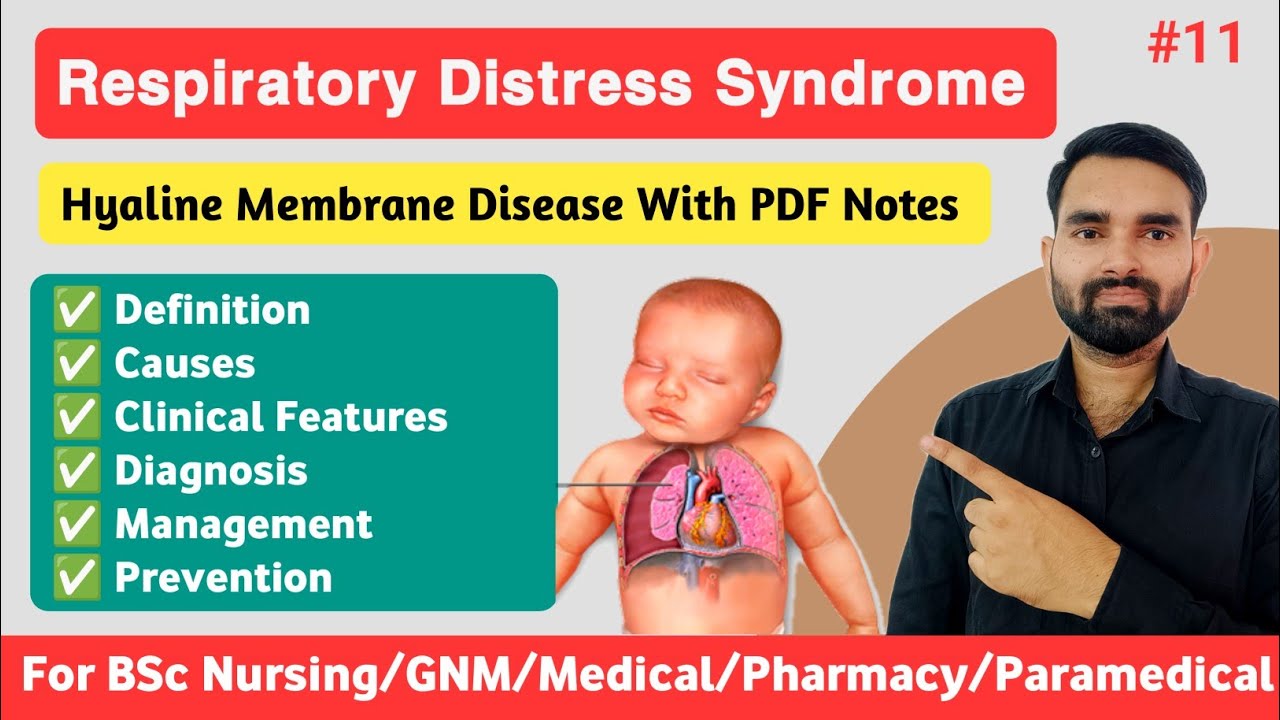 Respiratory Distress Syndrome in Newborn | Respiratory Distress Syndrome in Hindi