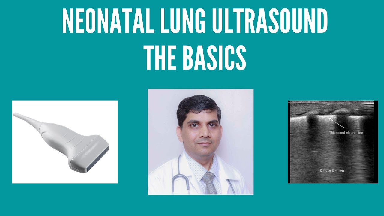 Lung ultrasound in neonates #pocus #lungultrasound