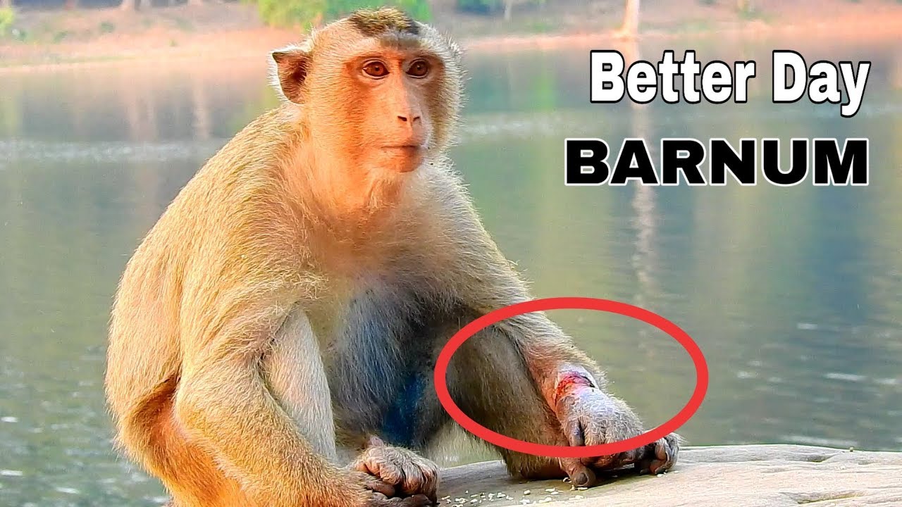 LAST UPDATE !! Barnum Get Hurt After Stuck Trap On Left Hand,Now His Hand Development To Better.