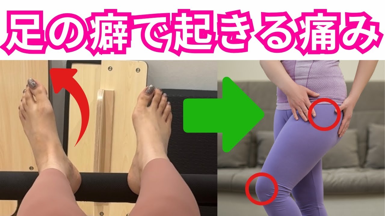 足の内側が浮く人ほど“膝と股関節”を痛めやすい理由！