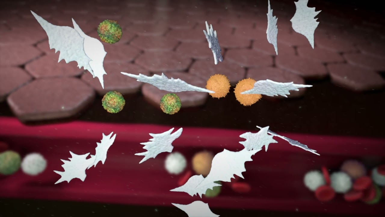 An Animated Exploration of CF-ILD: From Diagnosis to Management in the Era of Antifibrotic Therapy