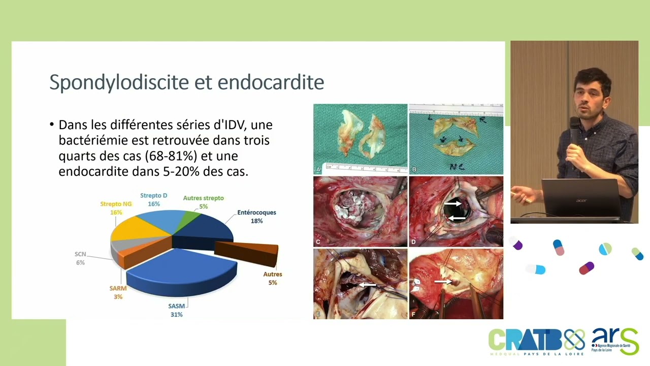 Spondylodiscite, Dr Raphaël LECOMTE (Replay JRATBREF 26-01-2023)