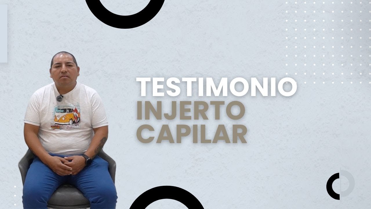 Testimonio de Injerto Capilar | Clinica Capilar Velazquez