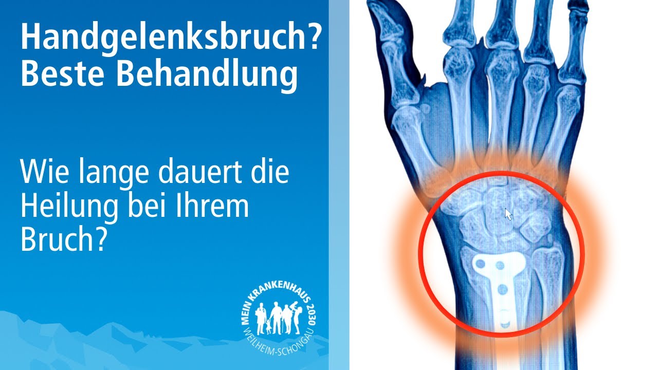 Handgelenksbruch: Diagnose, Komplikationen & Behandlung