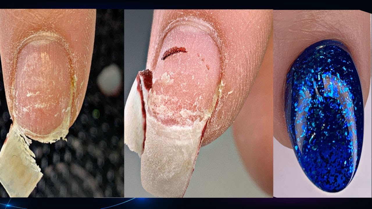 Жуткая отслойка😱Наращивание на ослабленный ноготь💅Идеальный маникюр на сухой кутикуле