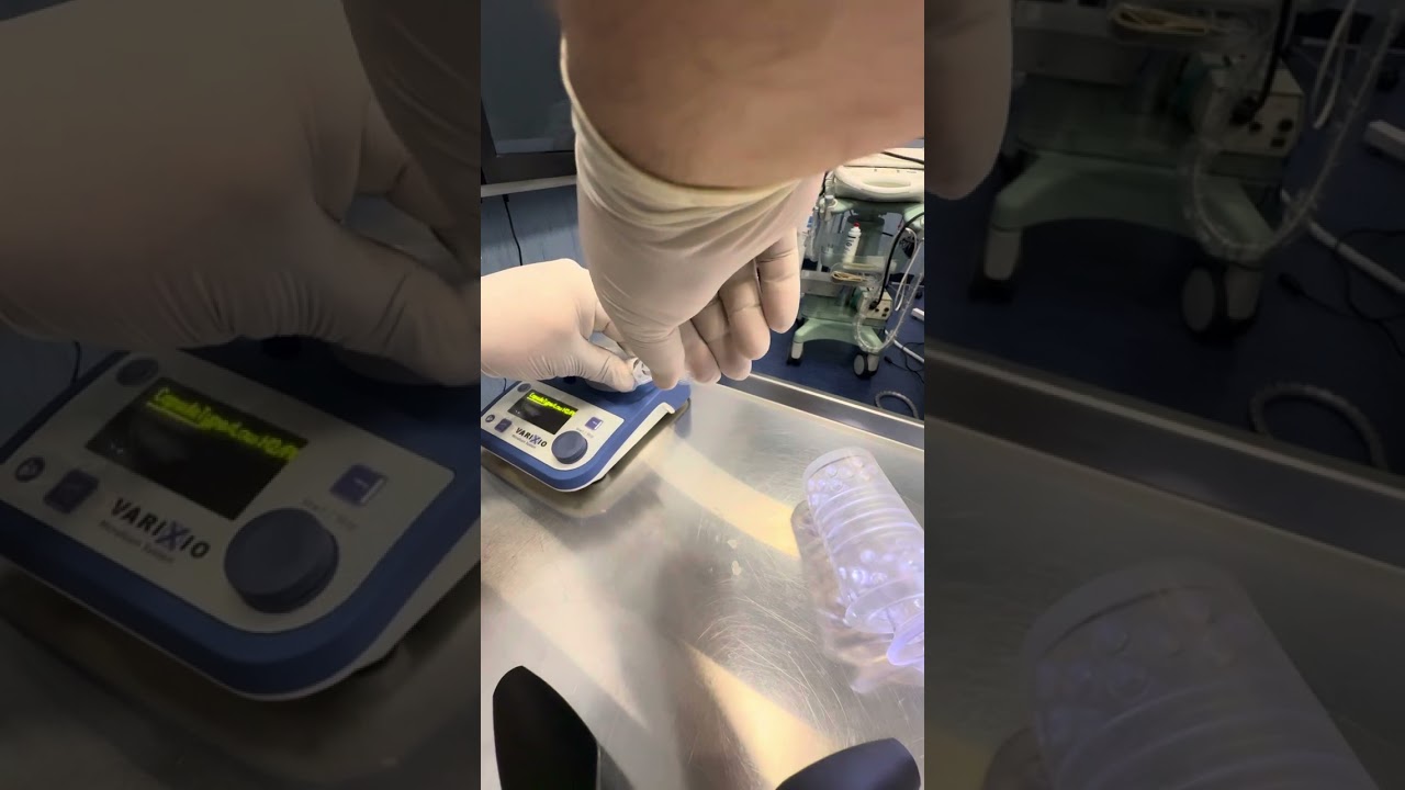 Emorroidi cura con la scleroterapia