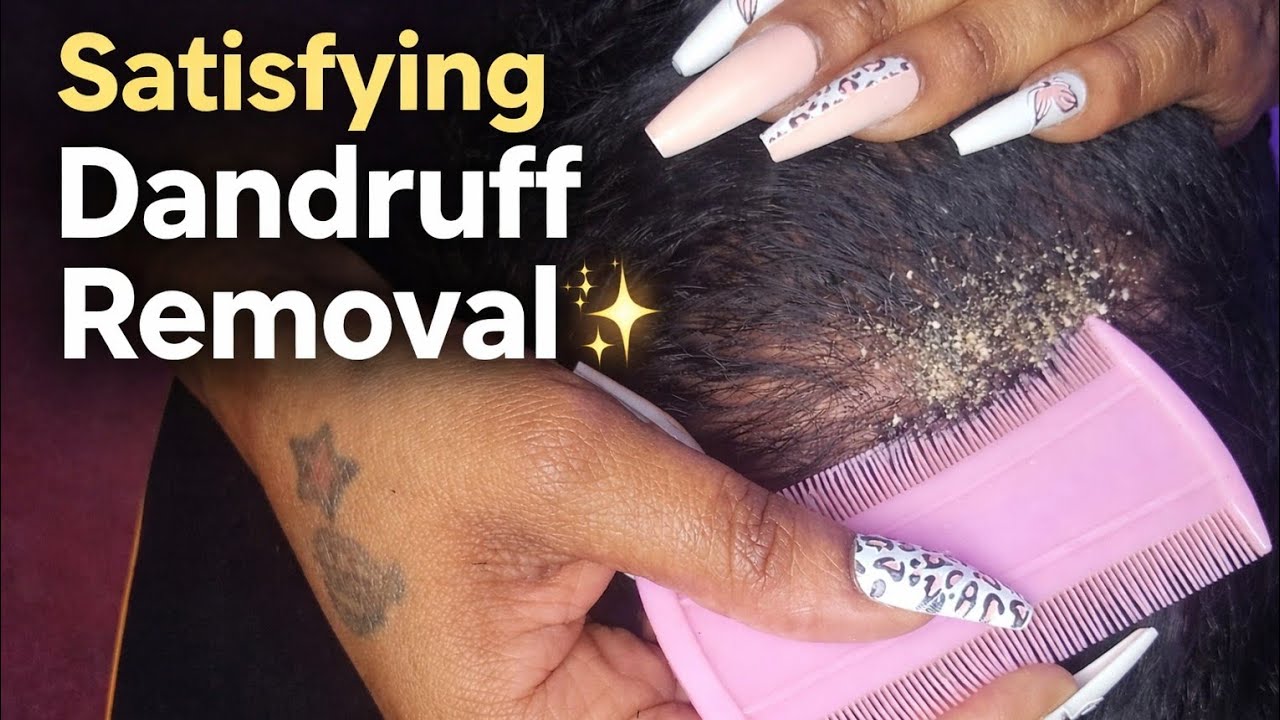 ASMR | Satisfying Dandruff Removal & Deep Scalp Scratching  Relief ✨
