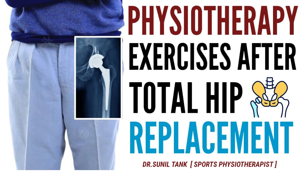 Physical Therapy Exercises After Total Hip Replacement Surgery