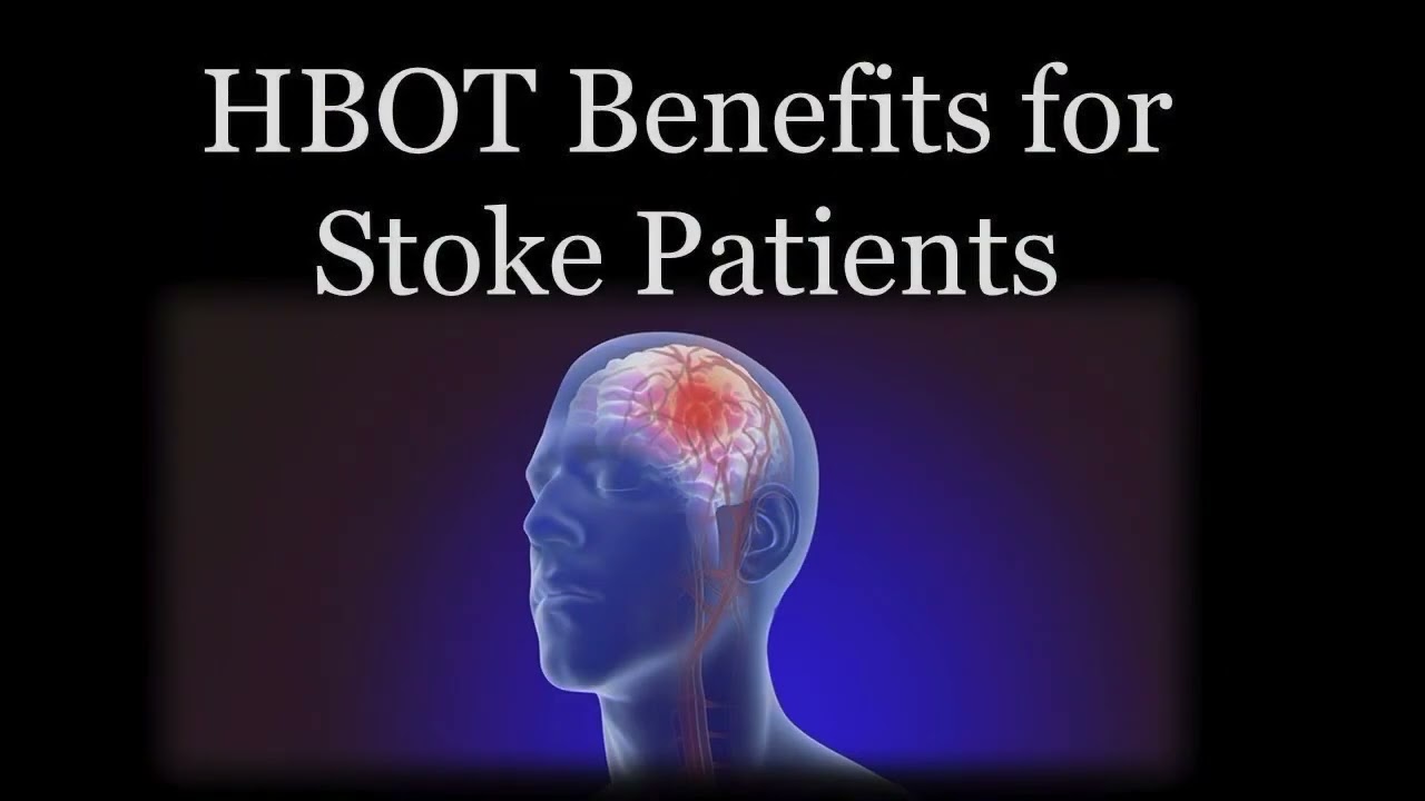 Hyperbaric Oxygen Therapy for Stroke
