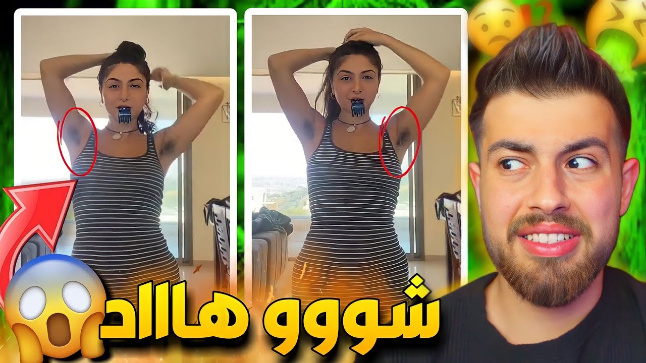 شعر الابط صاير موضة ؟! 🤢 ولا ازمة سكر 😂