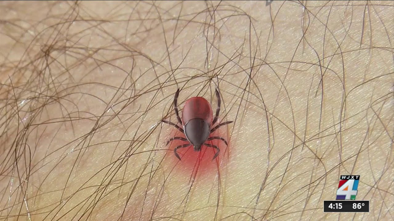 Avoid the blood-sucking bite: Keeping ticks away