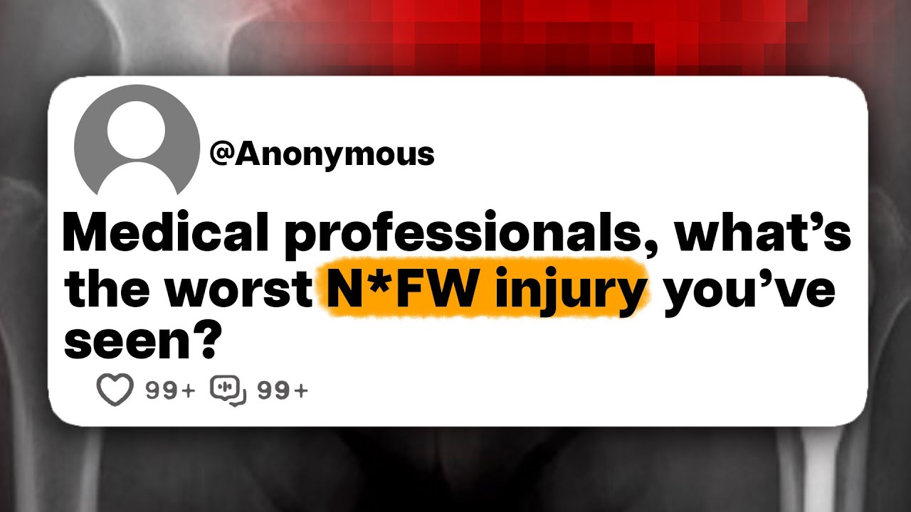 Medical professionals, what's the worst N*FW injury you've seen?