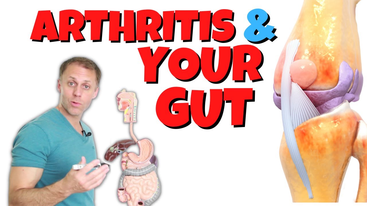 The Gut and Arthritis Connection