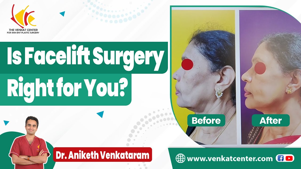 Подтяжка лица: процедура и преимущества | Омолаживающая хирургия в Индии | Центр Венката в Бангалоре