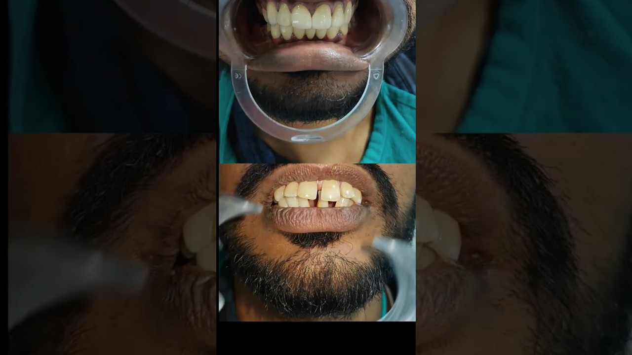 Smile Design 😊