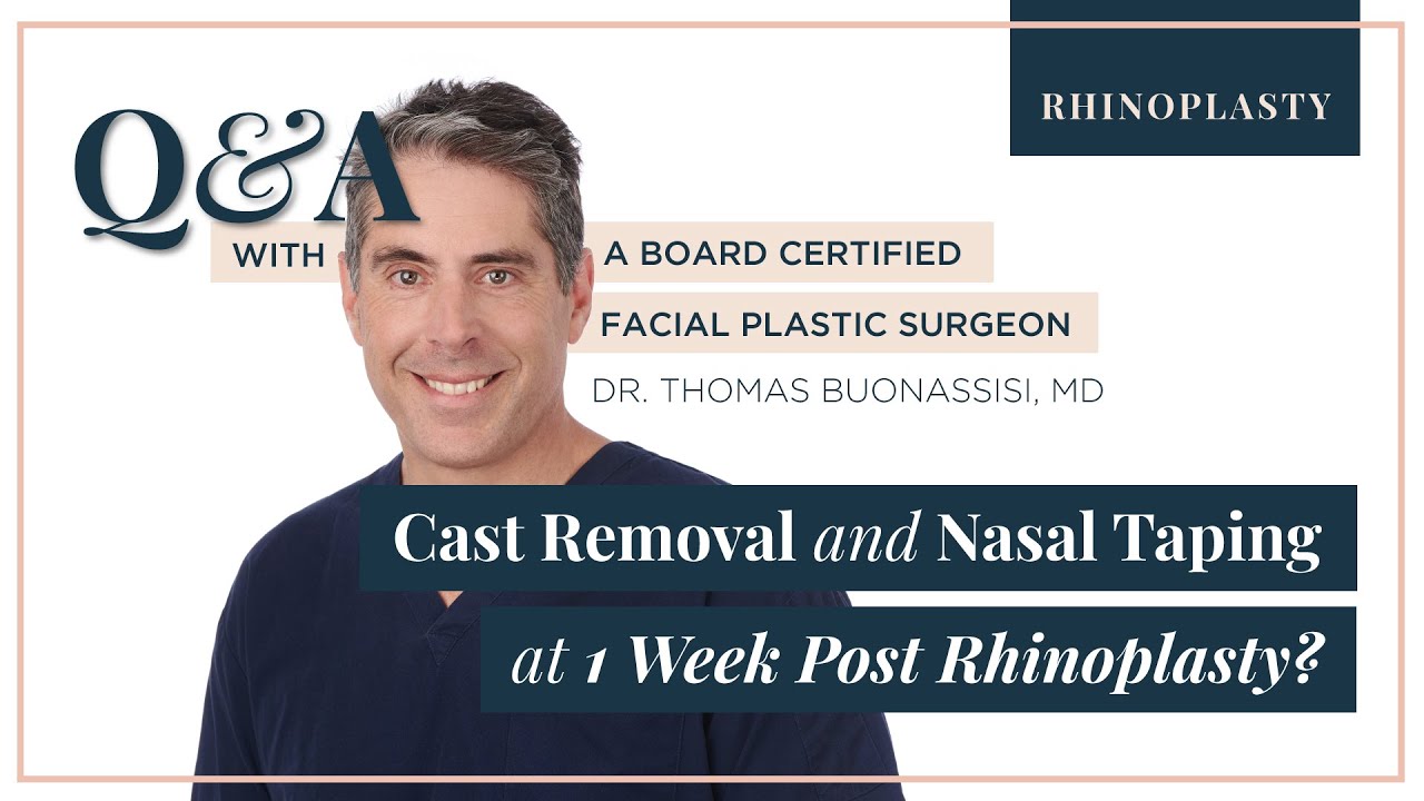 Cast Removal Aftercare and Nasal Taping Discussion with Ashley - RHINOPLASTY Q&A WITH DR. BUONASSISI