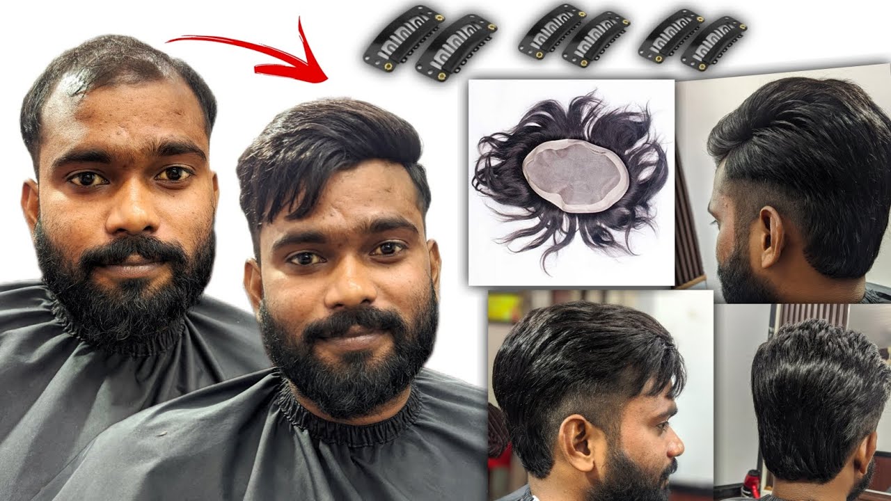 Hair Patch Clip System Review | Best Natural Hair Patch Clip System | Best Natural Looking patch