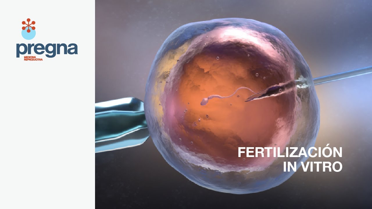 PREGNA - Fertilización in vitro