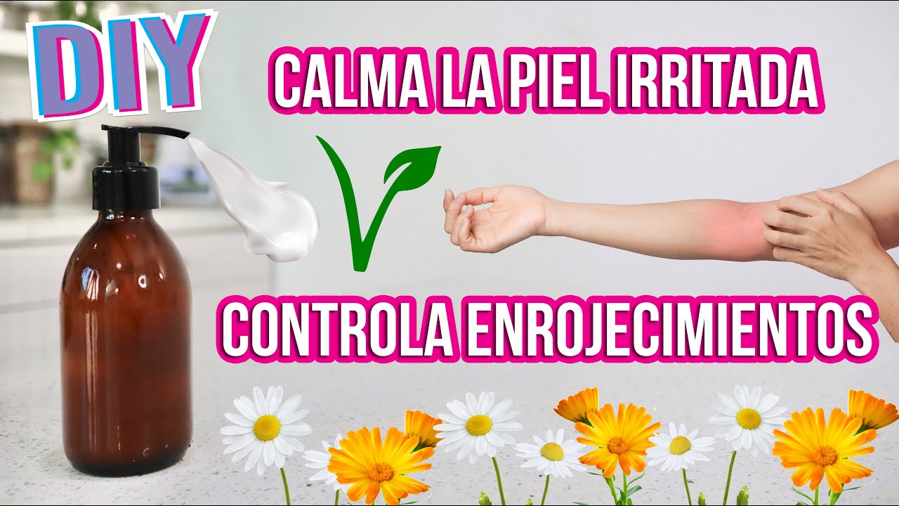 CREMA HIDRATANTE CALMANTE PARA PIEL IRRITADA - DIY - Mixi