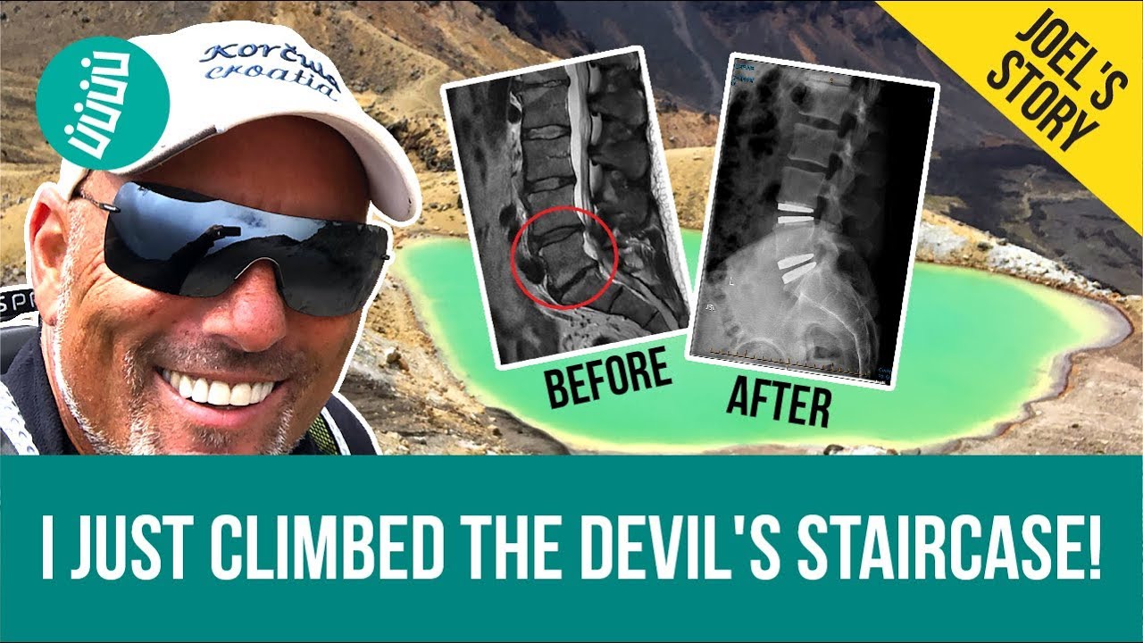 Family Man Avoids Spine Fusion with 2-Level ADR in Germany (Joel's Story)
