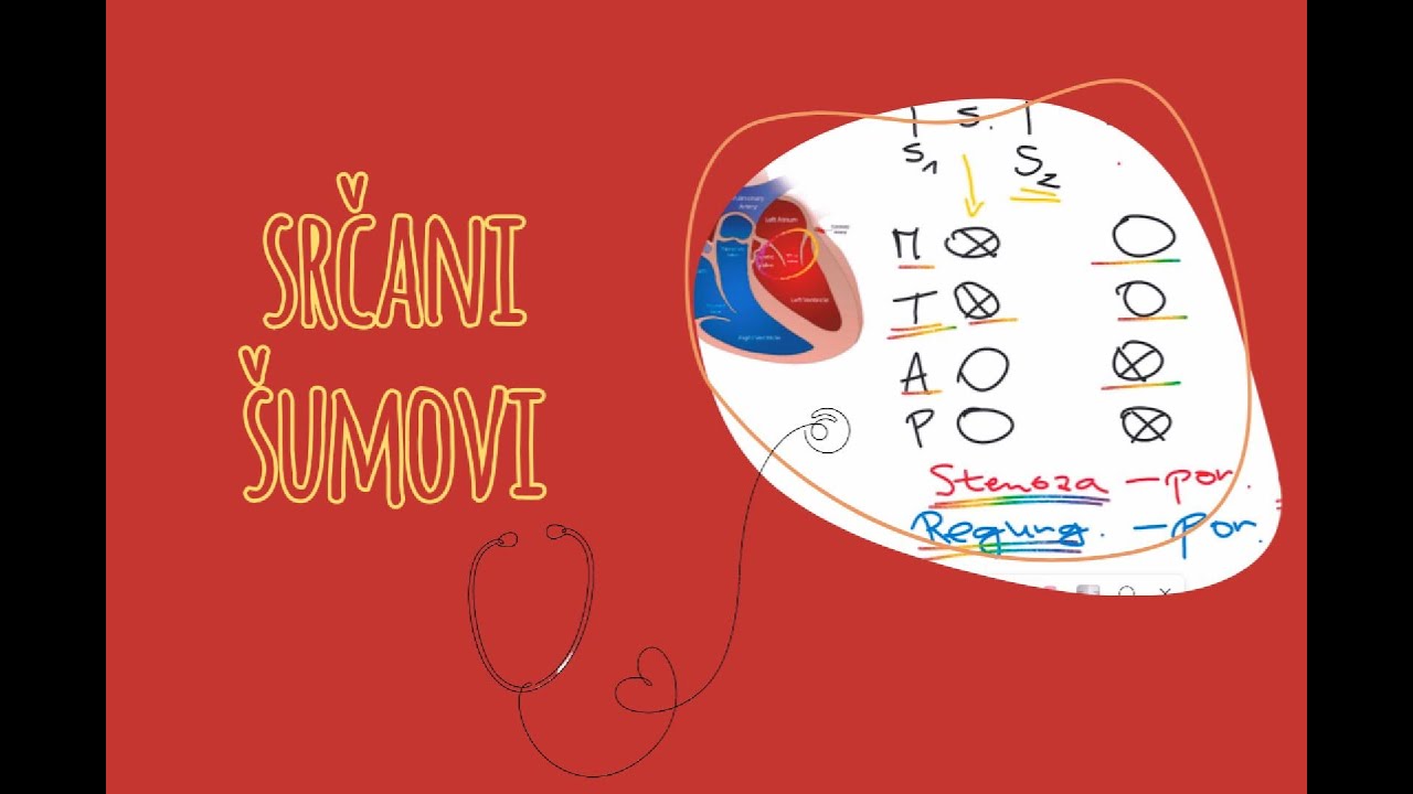 Auskultacija srca: Teorija o šumovima - stenoze i regurgitacije zalistaka