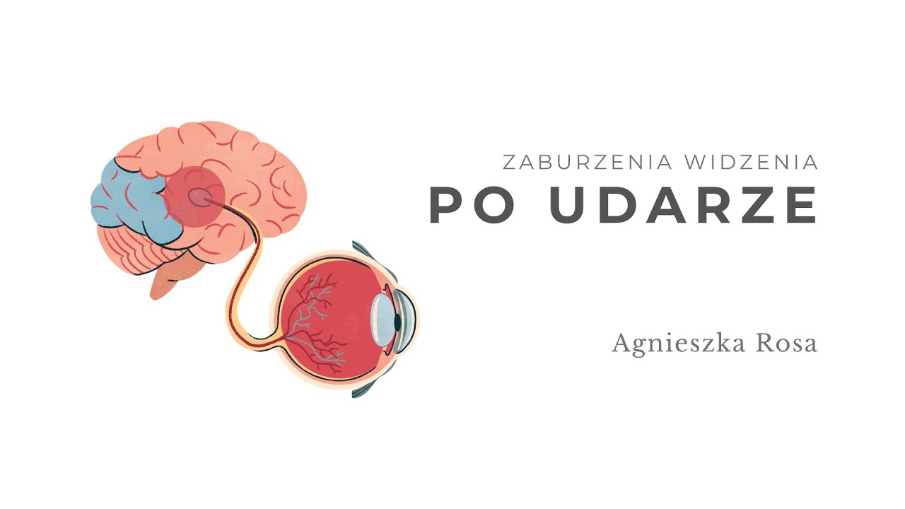 Zaburzenia widzenia po udarze. Agnieszka Rosa