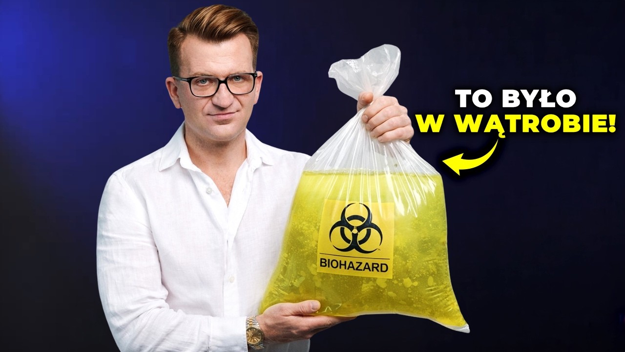 JAK USUNĄŁEM TONĘ TOKSYN Z CIAŁA? Oczyszczanie wątroby