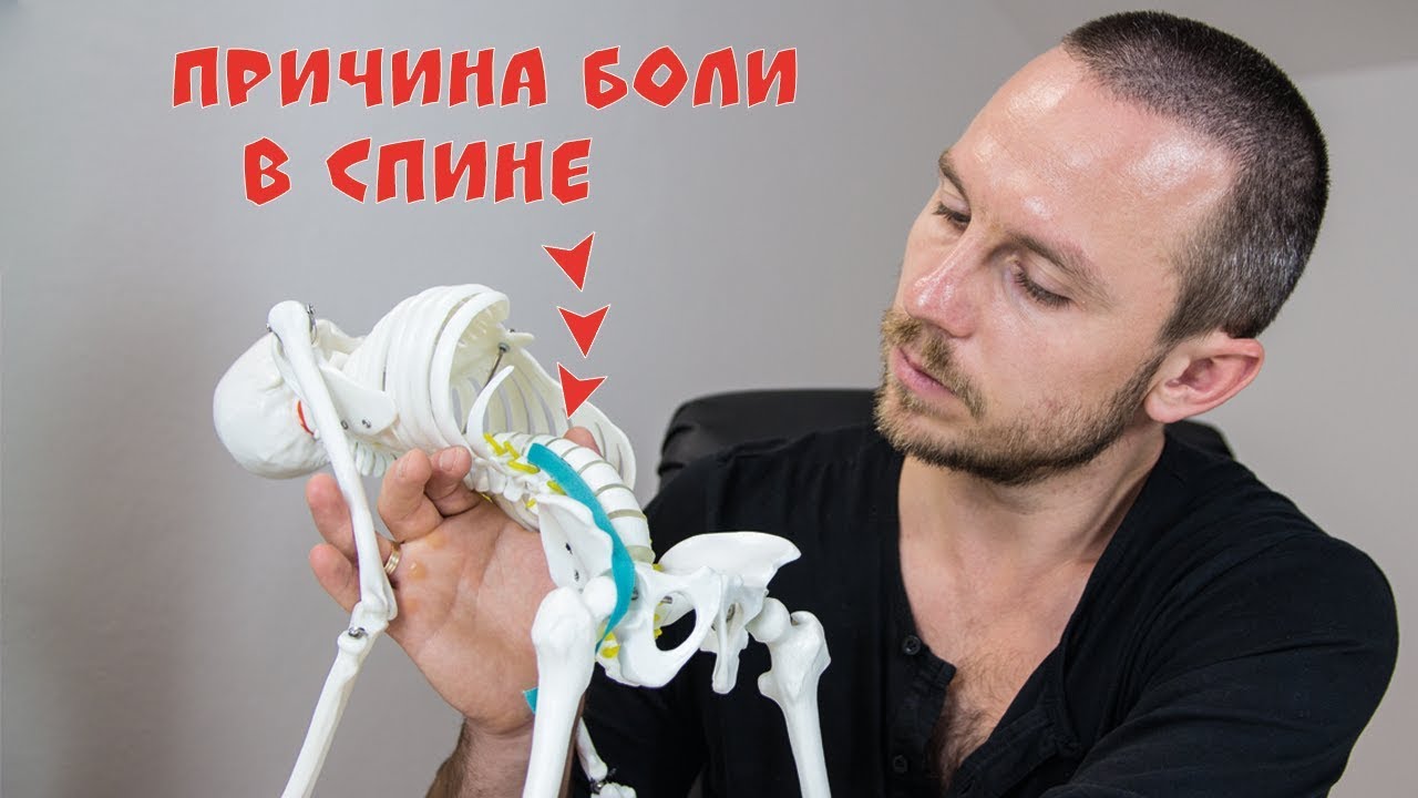 БОЛИТ СПИНА в области поясницы 🔴 Триггерные точки в подвздошно-поясничной мышце (ППМ)