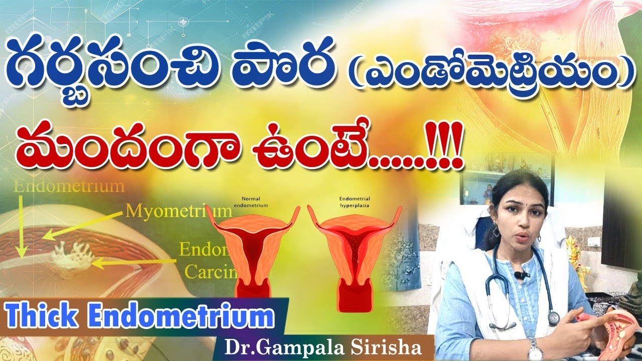Endometrial thickness; what is normal, Hyperplasia causes and treatment || Dr Gampala Sirisha