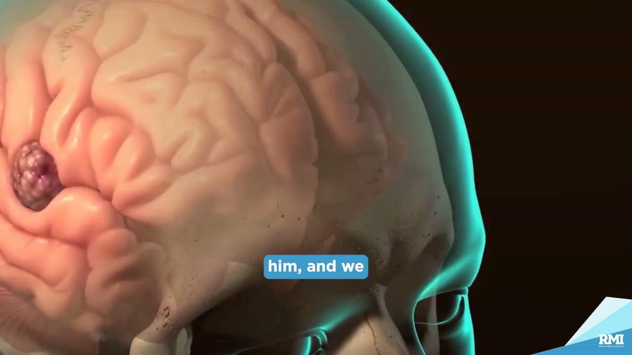 How Awake Brain Surgery Helps Safely Remove Brain Tumours | #patienttestimonial | #rmihealthcare