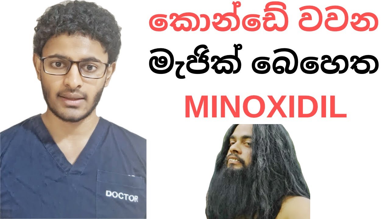 කොන්ඩේ වවන මැජික් බෙහෙත MINOXIDIL | MINOXIDIL for hairloss