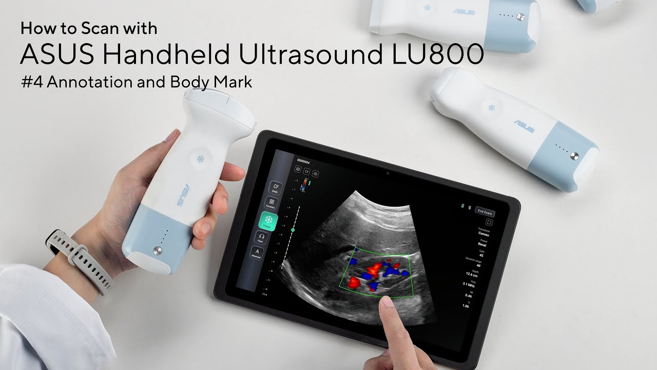 【ASUS Handheld Ultrasound LU800 Tutorial】#4 Annotation & Body Mark