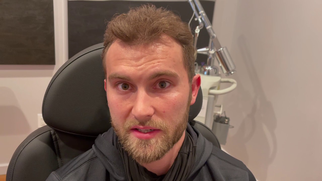 Dallas Botox Hyperhidrosis Testimonial