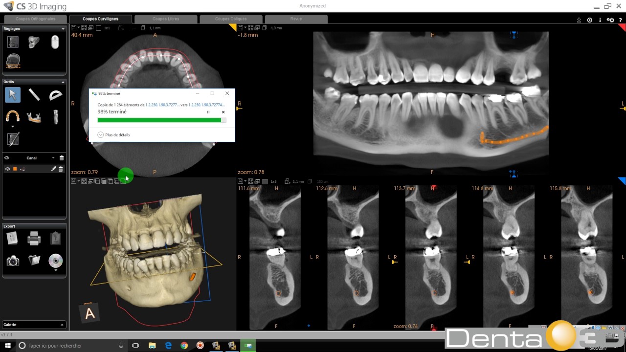 CS 3D Imaging - Export CD, DVD et USB