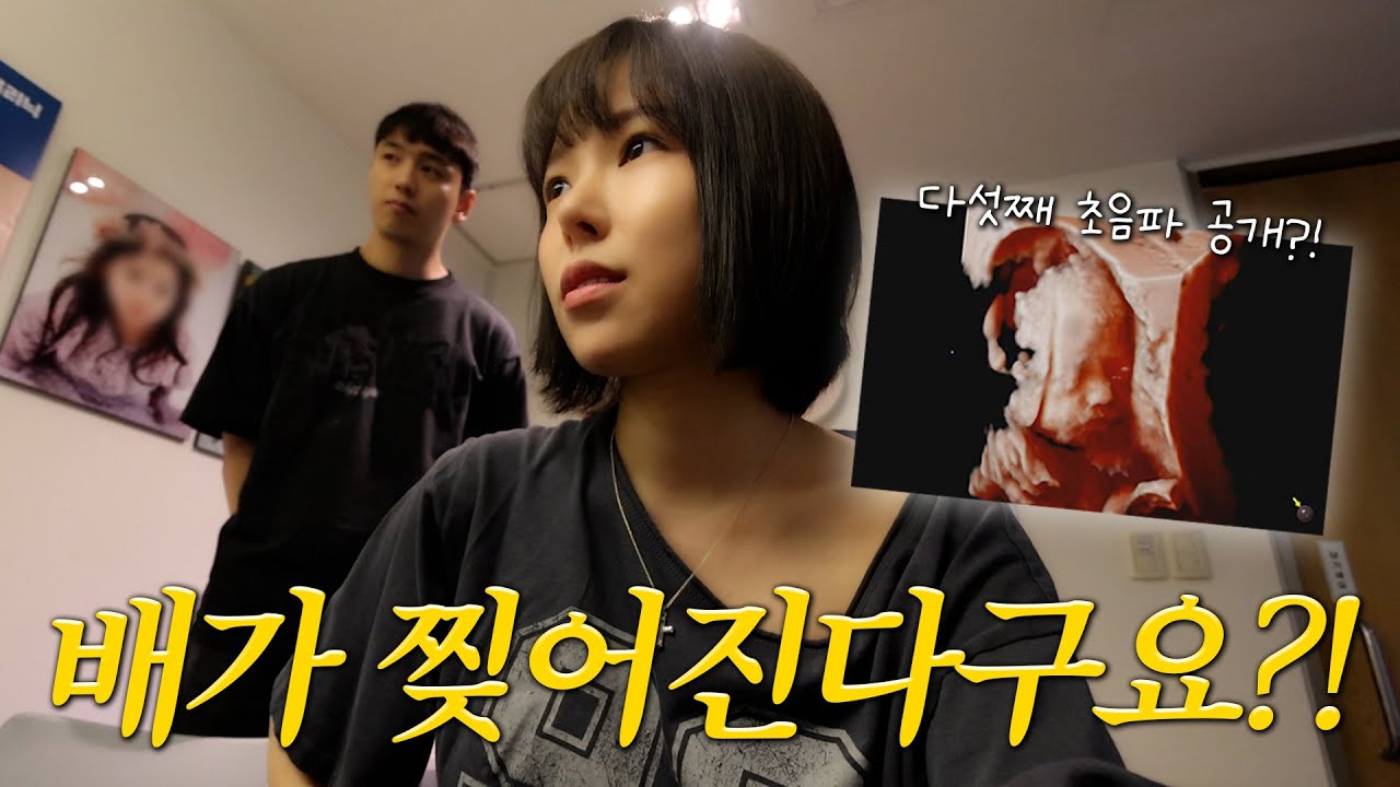다섯째 임신 30주차… 산부인과브이로그 (3D 입체초음파, 또또 얼굴공개)