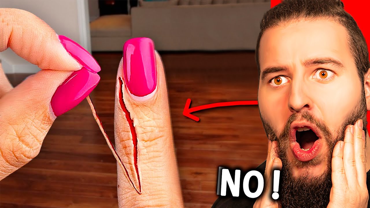 Todo El Dolor En Un Vídeo !!