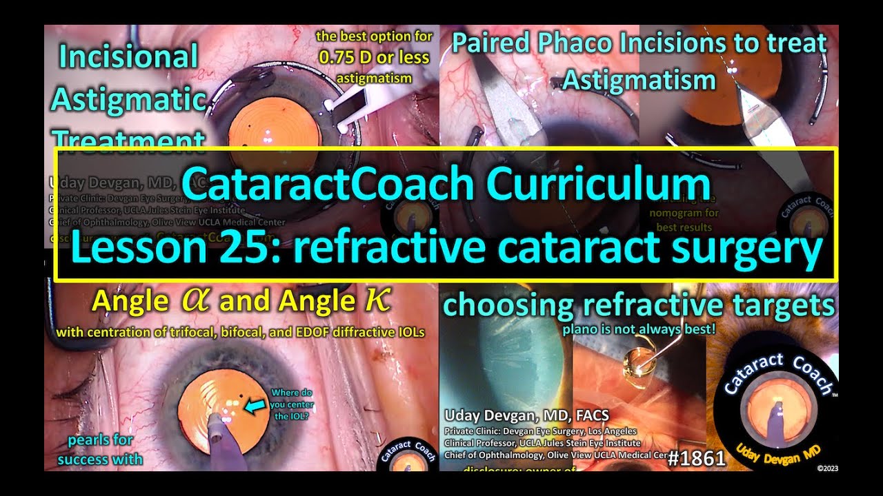 CataractCoach&trade; 1861: curriculum lesson 25: refractive cataract surgery