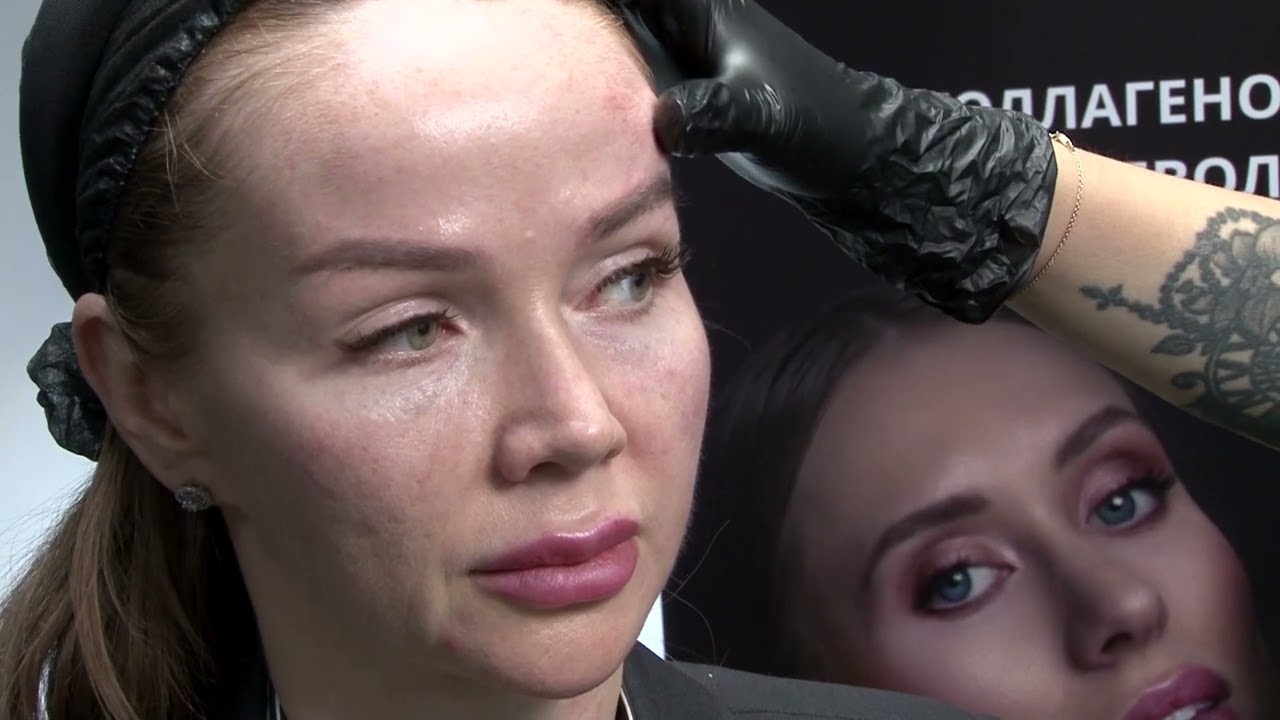 28 11 2023 GOURI Karisma LIVE INJECTION DEMONSTRATION Model 1