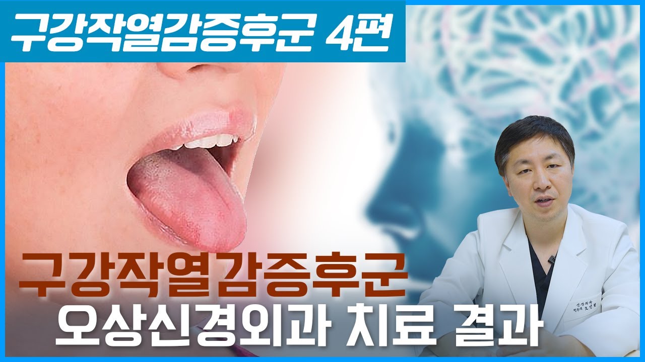구강작열감증후군은 입의 문제만은 아닙니다 - 4편