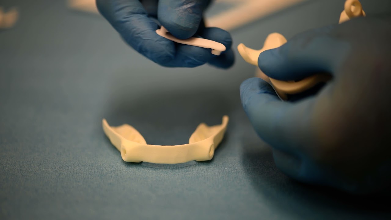 Panthera appliance: how to modify the advancement ot their splints?