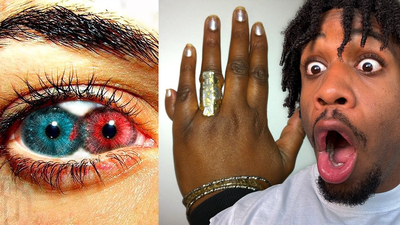 Deadly Accidents That Gave People Super Powers