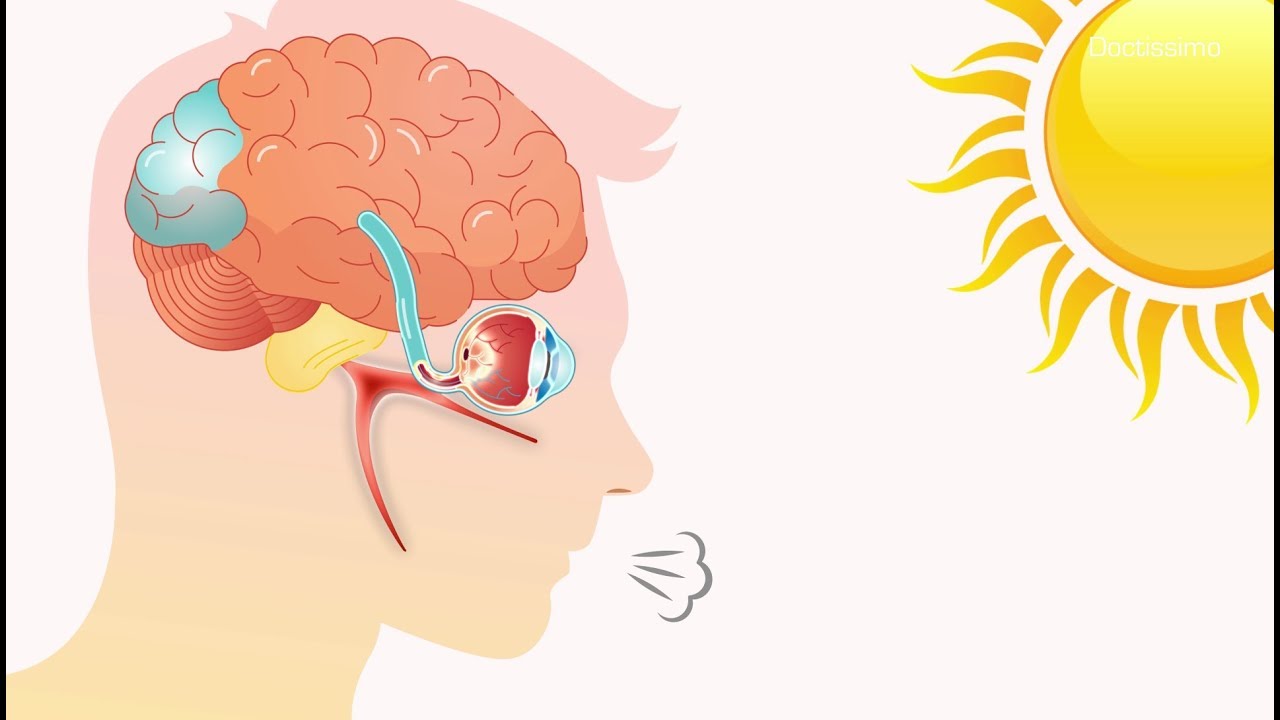 Pourquoi j’éternue au soleil ?
