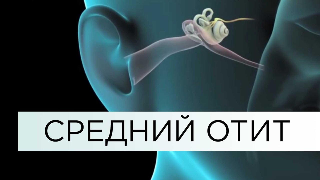 СРЕДНИЙ ОТИТ