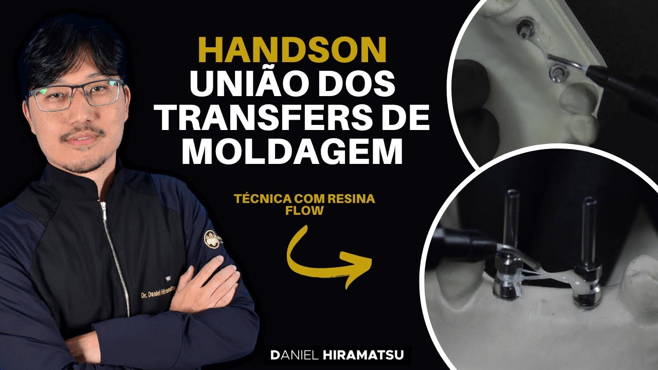 União dos Transfers de Moldagem | Parte 02: Técnica com Resina Flow - HandsOn