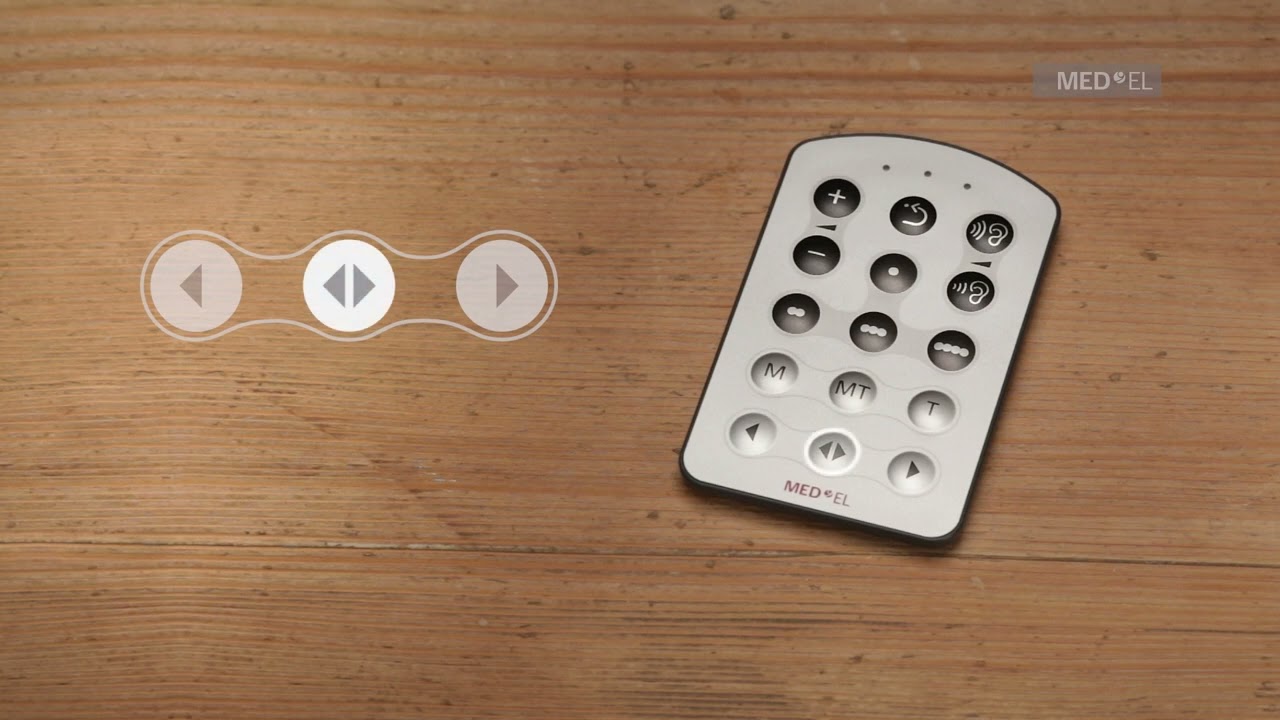 التطبيق العملي (14)  لـ SONNET: استخدام جهاز التحكم عن بعد FineTuner